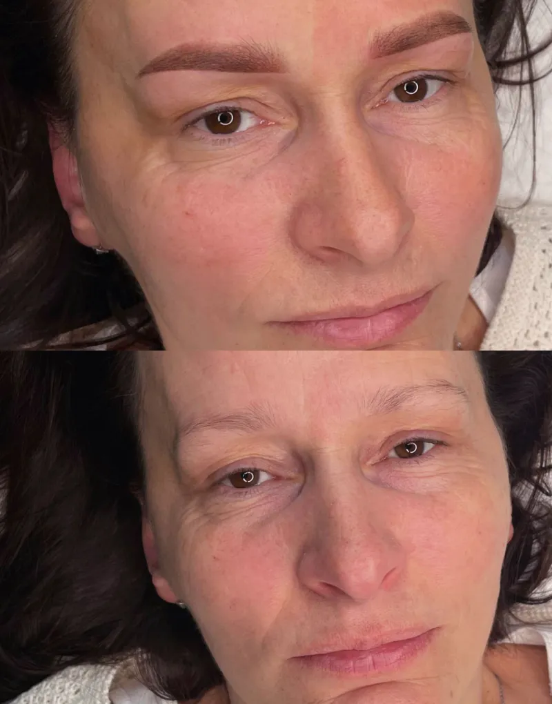 PMU powder brows - před a po